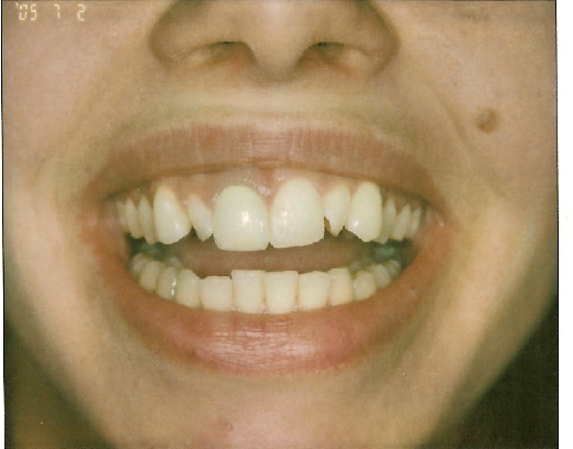 Amanda's Teeth