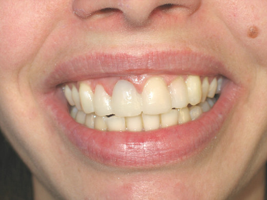 Amanda's Teeth