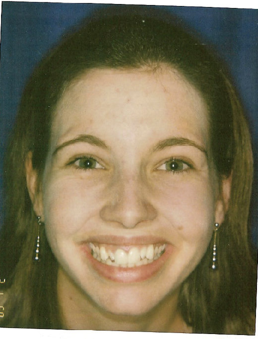 Amanda's Teeth